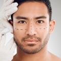 Understanding Botox: A Complete Guide to Facial Procedures