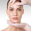 Understanding Facelift: Everything You Need to Know