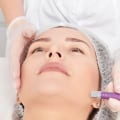 Exploring the Benefits of Microdermabrasion: A Complete Guide