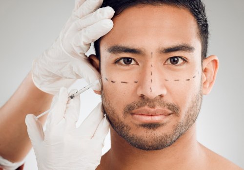 Understanding Botox: A Complete Guide to Facial Procedures