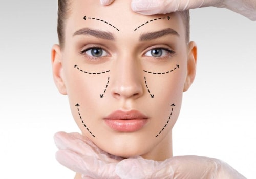 Understanding Facelift: Everything You Need to Know