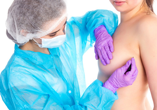 A Comprehensive Guide to Breast Lift Surgery