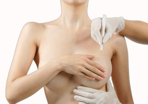 Breast Reconstruction: Understanding the Process and Finding a Qualified Plastic Surgeon