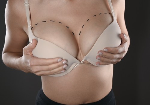 Breast Augmentation: Enhancing Your Appearance and Boosting Confidence