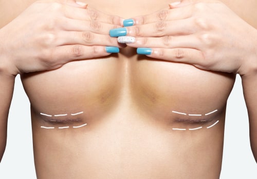 Understanding Breast Lift Surgery for a More Confident You