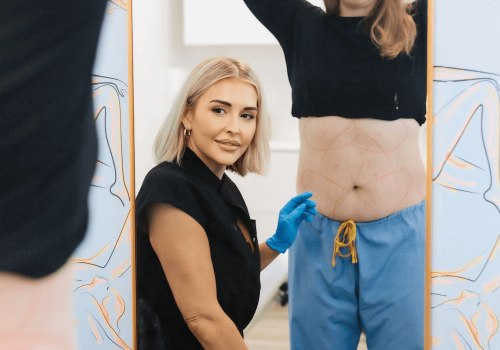 CoolSculpting: The Non-Surgical Solution to Your Body Goals