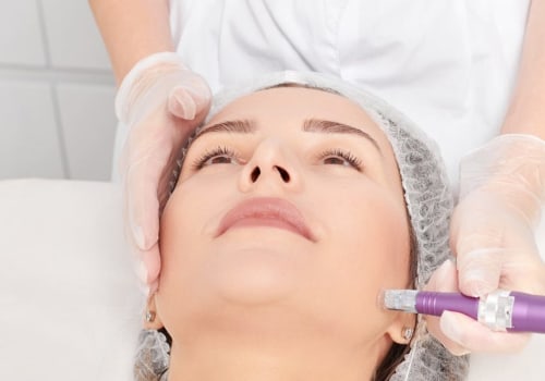 Exploring the Benefits of Microdermabrasion: A Complete Guide